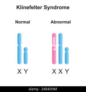 Progettazione scientifica della sindrome di Klinefelter (XXY). Simboli colorati. Illustrazione vettoriale. Illustrazione Vettoriale