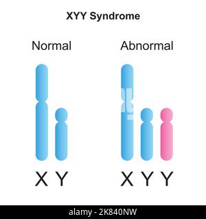 Progettazione scientifica della sindrome di Jacobs (XYY). Simboli colorati. Illustrazione vettoriale. Illustrazione Vettoriale