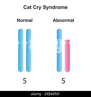Progettazione scientifica della sindrome di Cat Cry. Simboli colorati. Illustrazione vettoriale. Illustrazione Vettoriale