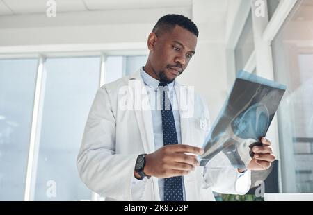 Lo vedo meglio in una buona illuminazione: Un giovane medico che esamina una radiografia in un ufficio. Foto Stock