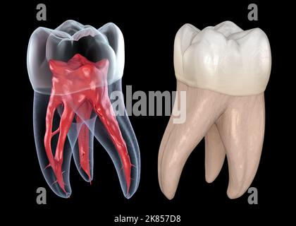 Anatomia della radice dentale - primo dente molare mascellare. Illustrazione dentale 3D accurata dal punto di vista medico Foto Stock