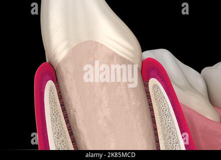 Morfologia del dente e della gengiva dell'incisore laterale mascellare. Illustrazione dentale 3D accurata dal punto di vista medico Foto Stock