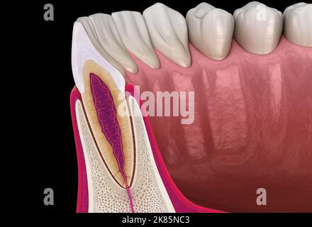 Anatomia del dente e della gengiva dell'incisore laterale mascellare (sezione trasversale). Illustrazione dentale 3D accurata dal punto di vista medico Foto Stock