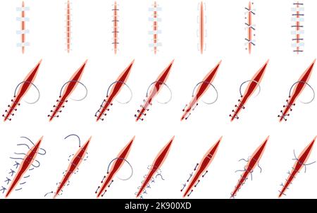 Le icone di sutura impostano il vettore dei cartoni animati. Chirurgia della ferita Illustrazione Vettoriale