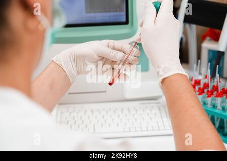 Analisi del sangue sull'analizzatore in primo piano di laboratorio. Assistente di laboratorio esegue analisi ematologiche. Apparecchiature mediche in laboratorio. Biochimico e HE Foto Stock