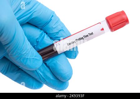 Bleeding Clotting Time Test controllo medico provetta con campione biologico Foto Stock