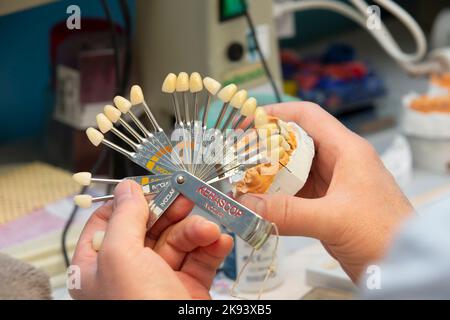 Una tavolozza per determinare il colore dei denti nelle mani di un ortopedico dentale. Foto Stock