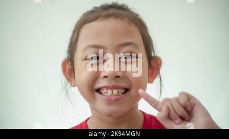 Felice bambino asiatico in rosso mostrando i suoi denti decaduto in fuoco selettivo Foto Stock