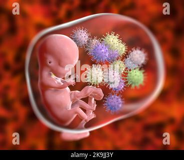 Trasmissione transplacentale di Cytomegalovirus, illustrazione Foto Stock