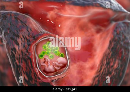 Trasmissione transplacentale di Cytomegalovirus, illustrazione Foto Stock