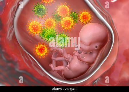 Trasmissione transplacentale di Cytomegalovirus, illustrazione Foto Stock