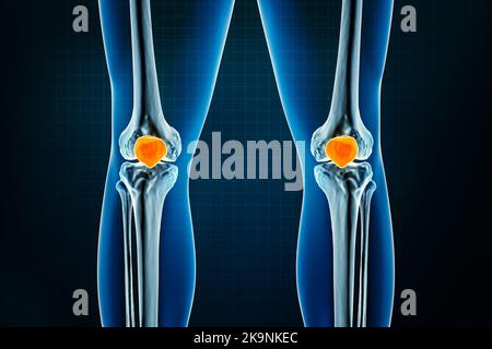 Vista frontale o anteriore radiologica della rotula o dell'osso della ginocchia. Osteologia dello scheletro umano, delle ossa delle gambe o degli arti inferiori 3D che rende illustrazione. Anatomia, farmaco Foto Stock