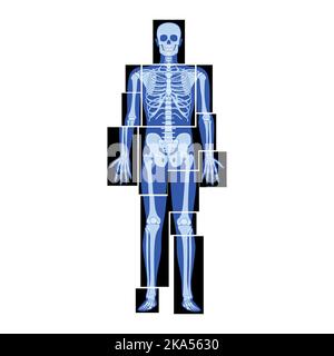 Set di parti del corpo umano dello scheletro radiogeno: Mani, gambe, torace, testa, vertebre pelvi, Ossa persone adulte roentgen vista frontale. 3D concetto realistico di colore blu piatto rappresentazione vettoriale dell'anatomia medica Illustrazione Vettoriale