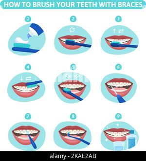 Igiene dentale serie piatta di composizioni infografiche rotonde che mostrano le fasi della bocca di pulizia dei denti con illustrazione vettoriale delle bretelle Illustrazione Vettoriale