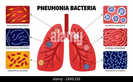 Batteri polmonari umani con immagini isolate di forma anatomica dei polmoni con campioni di illustrazione vettoriale dei batteri infettivi Illustrazione Vettoriale