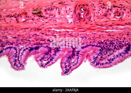 Human cistifellea sezione fotomicrografia in campo chiaro Foto Stock