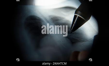 Radiografia polmonare estrema primo piano, medico o professore che effettua esami a raggi X con penna, concetto di medicina Foto Stock