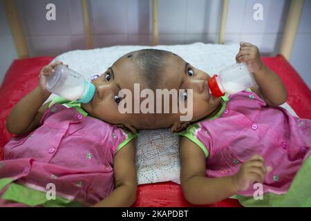 Le ragazze gemelle Rabeya Islam e Rokeya Islam bevono latte in un ospedale a Dhaka, Bangladesh, il 29 luglio 2017. Taslima Khatun, insegnante di scuola, ha dato alla luce i gemelli a testa riunita il 16 luglio 2016 dopo un cesareo. I gemelli sono stati ricoverati in un ospedale governativo per un esame prima di un eventuale intervento chirurgico per separare la testa. (Foto di Zakir Hossain Chowdhury/NurPhoto) *** Please use Credit from Credit Field *** Foto Stock
