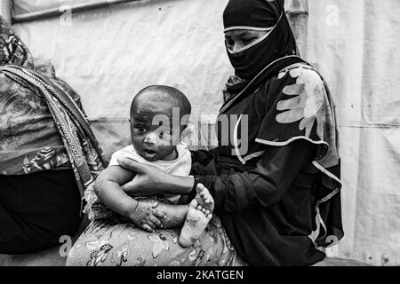 La donna rifugiata Rohingya tiene il suo bambino con infezione della pelle nel campo profughi di Balukhali vicino a Bazar di Cox, Bangladesh, 22 novembre 2017. (Foto di Szymon Barylski/NurPhoto) Foto Stock