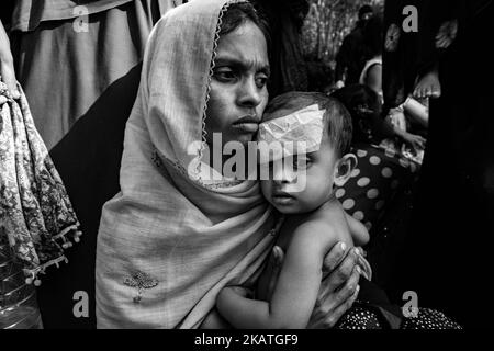La donna rifugiata Rohingya tiene il suo bambino con lesioni alla testa sta aspettando assistenza medica in una clinica sul campo da parte dell'organizzazione non governativa Mercy Malaysia al campo profughi di Thankhali vicino a Cox's Bazar, Bangladesh, 22 novembre 2017. (Foto di Szymon Barylski/NurPhoto) Foto Stock