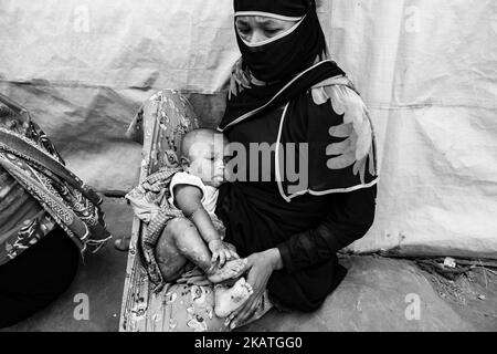 La donna rifugiata Rohingya tiene il suo bambino con infezione della pelle nel campo profughi di Balukhali vicino a Bazar di Cox, Bangladesh, 22 novembre 2017. (Foto di Szymon Barylski/NurPhoto) Foto Stock