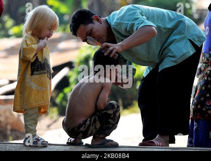 Jajang Gunuwan 3 anni uno dei figli di discesa Albino con suo padre nella città di Ciburuy, Garut, Giava Ovest, il 26,2018 luglio. Ci sono nove albini nel villaggio di ciburuy che lo rendono il villaggio con il più alto tasso di albinismo in Indonesia. La gente del posto lo chiama albino come 'Walanda Sundaa' chiamato persone bianche con alcune limitazioni, abbagliamento quando esposto alla luce del sole, colore della pelle che diventa rosso quando si spostano gli adulti perché spesso esposti al sole. (Foto di Dasril Roszandi/NurPhoto) Foto Stock