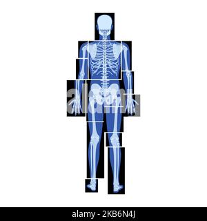 Set di parti del corpo umano dello scheletro radiogeno - mani, gambe, torace, testa, vertebra, Pelvi, ossa persone adulte roentgen vista posteriore. 3D concetto realistico di colore blu piatto rappresentazione vettoriale dell'anatomia medica Illustrazione Vettoriale