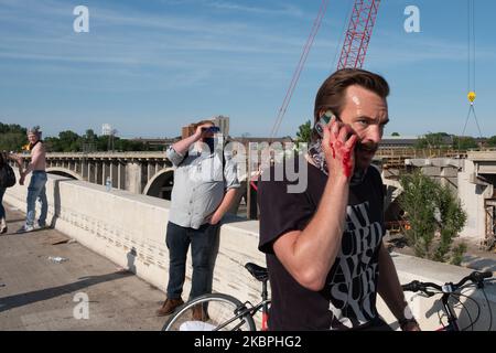 Nell'uomo ferito effettua una telefonata dopo che un camion di carburante ha guidato attraverso una folla di migliaia sul ponte i-35W a Minneapolis, Minnesota. 31 maggio 2020. (Foto di Tim Evans/NurPhoto) Foto Stock