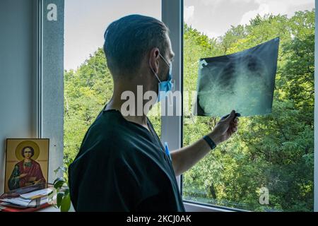 Un medico verifica una radiografia polmonare di un paziente con coronavirus nelle cure intensive dell'Ospedale clinico di Oleksandrivska a Kiev, Ucraina. Alcuni dei pazienti affetti da coronavirus sviluppano una polmonite o fibrosi nei polmoni. (Foto di Celestino Arce/NurPhoto) Foto Stock
