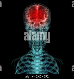 3D ha reso clinicamente accurata l'illustrazione dell'arteria cerebrale della testa Foto Stock