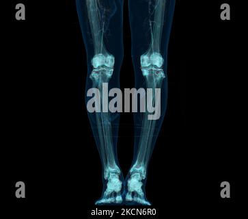 3D rappresentazione dell'estremità inferiore o delle gambe isolate su sfondo nero. Foto Stock