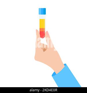 Composizione del sangue PRP, illustrazione concettuale Foto Stock