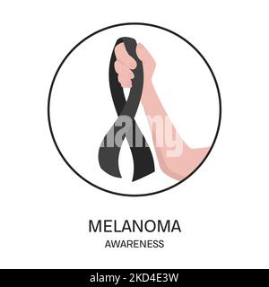 Melanoma, illustrazione concettuale Foto Stock