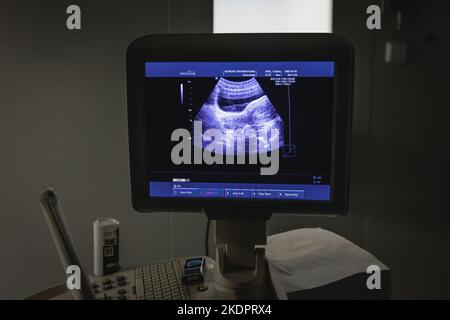 Dispositivo di monitoraggio ecografico medico in clinica Foto Stock