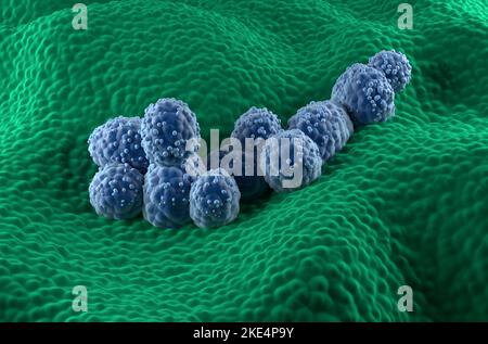 Cellule tumorali della prostata nell'epitelio ghiandolare prostatico - vista isometrica 3D illustrazione Foto Stock