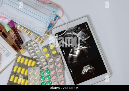 Durante l'ecografia prenatale e il cardiogramma il medico prescriverà un trattamento per conservare il bambino nell'utero diversi medicinali saranno prescritti Foto Stock