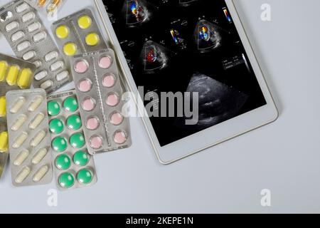 Il medico sulla compressa digitale controlla i risultati ecocardiografia ecografia dell'esame cardiaco per prescrivere un trattamento efficace in ufficio medico Foto Stock
