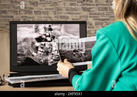 Radiografia panoramica dei denti dei bambini di due mascelle ...