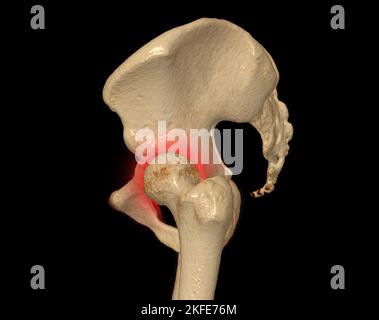 Scansione TC dell'osso pelvico e dell'articolazione dell'anca rendering 3D per diagnosi frattura dell'osso pelvico e dell'articolazione dell'anca isolata su sfondo nero. Foto Stock