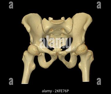 Scansione TC dell'osso pelvico e dell'articolazione dell'anca rendering 3D per diagnosi frattura dell'osso pelvico e dell'articolazione dell'anca isolata su sfondo nero. Foto Stock