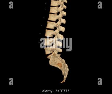 Scansione TC del rendering colonna lombare 3D che mostra il profilo colonna vertebrale umana. Sistema muscoloscheletrico corpo umano. Colonna vertebrale strutturale. Studiare la malattia di problema e tre Foto Stock