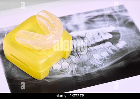 Set di attivatori e allineatori individuali per il trattamento ortodontico che correggono il morso profondo, il morso distale, il morso aperto lieve e la posizione errata della lingua Foto Stock