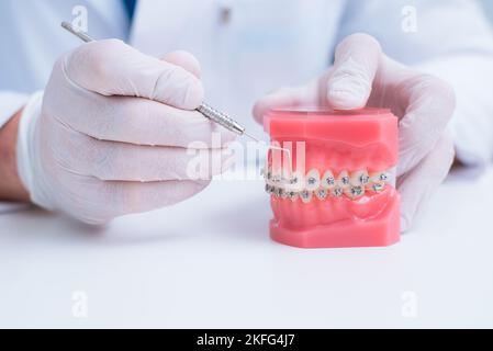 Il medico mostra come il sistema di bretelle sui denti è disposto Foto Stock