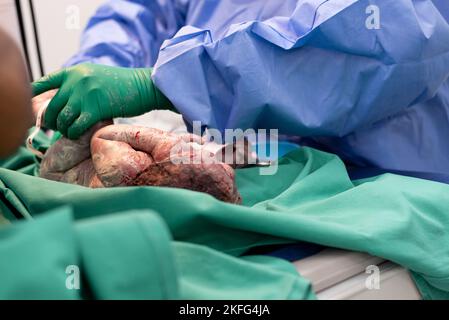 Un neonato che viene pulito da un pediatra immediatamente dopo la nascita Foto Stock