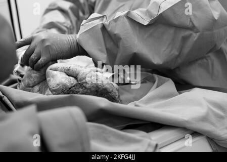 Un neonato che viene pulito da un pediatra immediatamente dopo la nascita Foto Stock