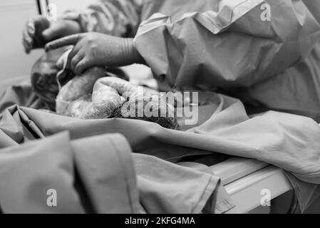 Un neonato che viene pulito da un pediatra immediatamente dopo la nascita Foto Stock