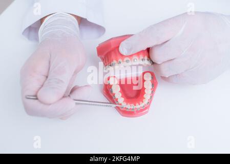 Il medico mostra come il sistema di bretelle sui denti è disposto Foto Stock