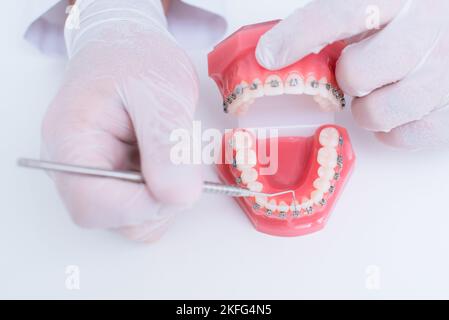 Il medico mostra come il sistema di bretelle sui denti è disposto Foto Stock