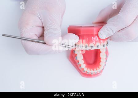 Il medico mostra come il sistema di bretelle sui denti è disposto Foto Stock