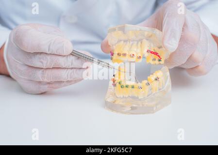 Il medico mostra come il sistema di bretelle sui denti è disposto Foto Stock